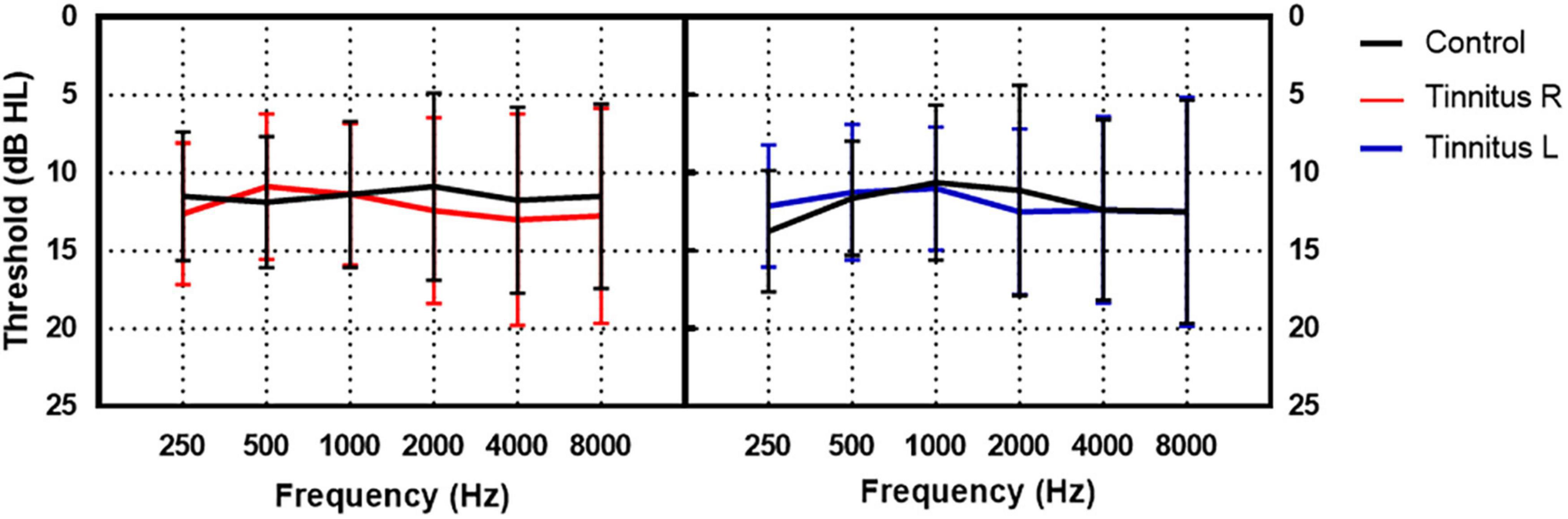 The interference of tinnitus on sound localization was related to the type of stimulus
